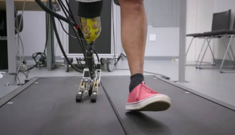 Разработан протез ноги с самой реалистичной ступней. Фото.