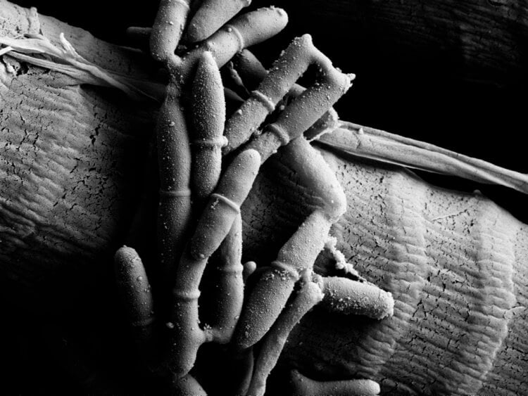 Как грибы-паразиты превращают муравьев в зомби? Грибок превращает насекомых в зомби. Фото.