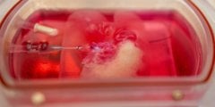 Ученые впервые вырастили человеческую печень в лаборатории. Фото.