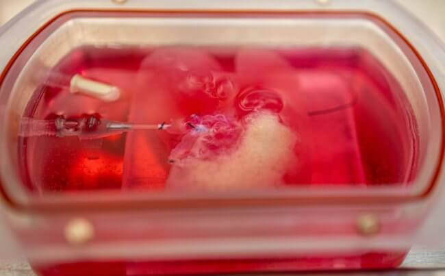 Ученые впервые вырастили человеческую печень в лаборатории. Фото.