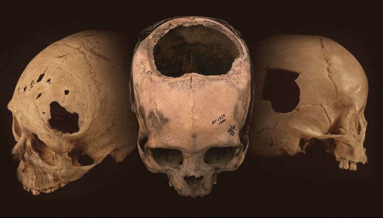 Почему древние инки отрубали врагам головы? Древние инки не просто отрубали головы — они их уродовали. Фото.
