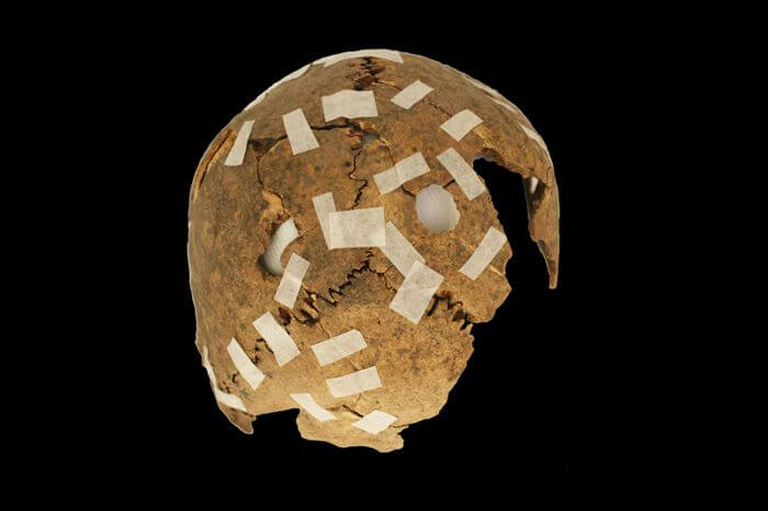 Жестокие народы древности. Один из черепов, обнаруженных в Чили. Фото.