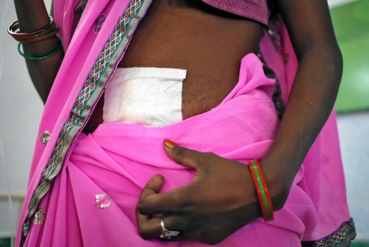 Вымираем ли мы? Миллионы индийских женщин были вынуждены пройти обязательную стерилизацию из-за угрозы перенаселения страны. Фото.