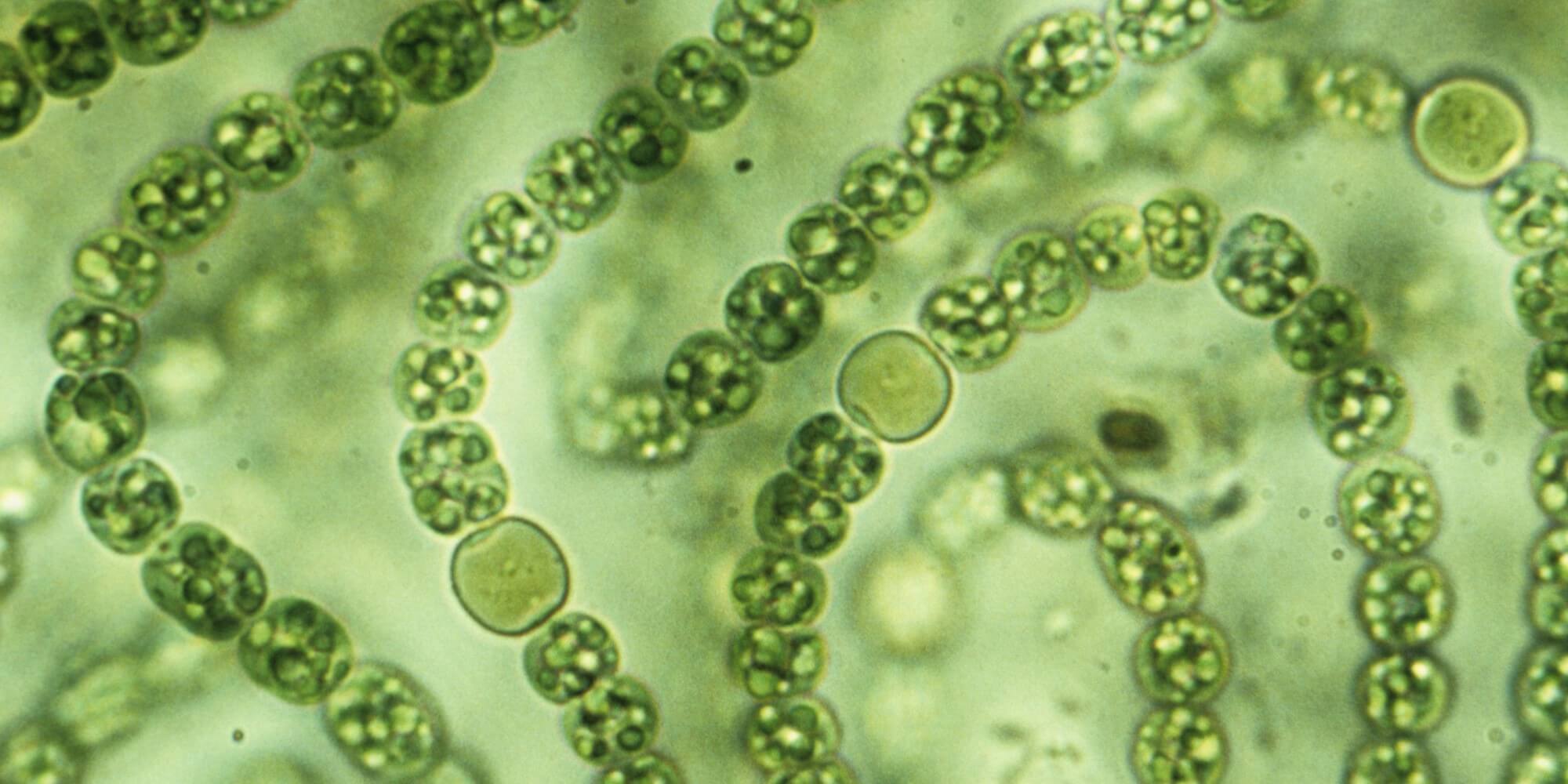 Автотрофные прокариоты. Синезелёные водоросли цианобактерии. Цианобактерии носток. Цианобактерии Анабена. Цианобактерии сине-зеленые водоросли.