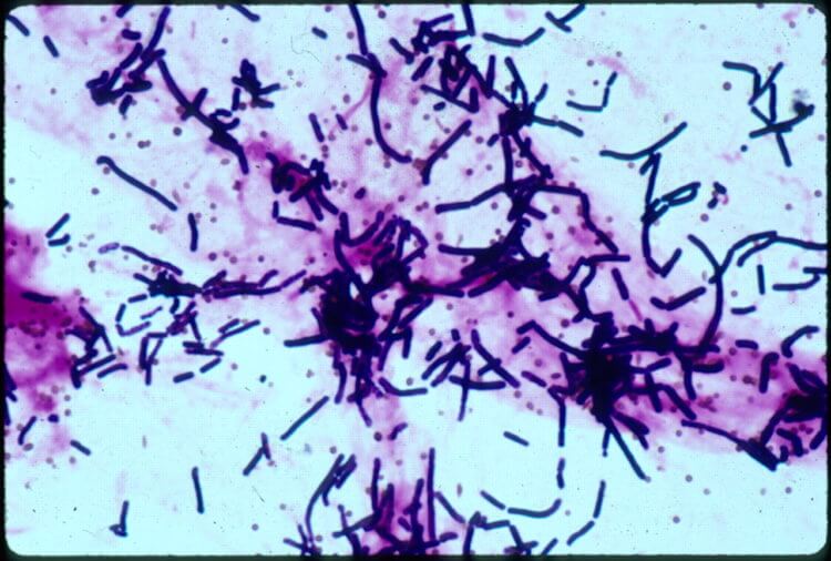 Бактерии мутируют, чтобы выжить. А так под микроскопом выглядит Bacillus cereus. Фото.