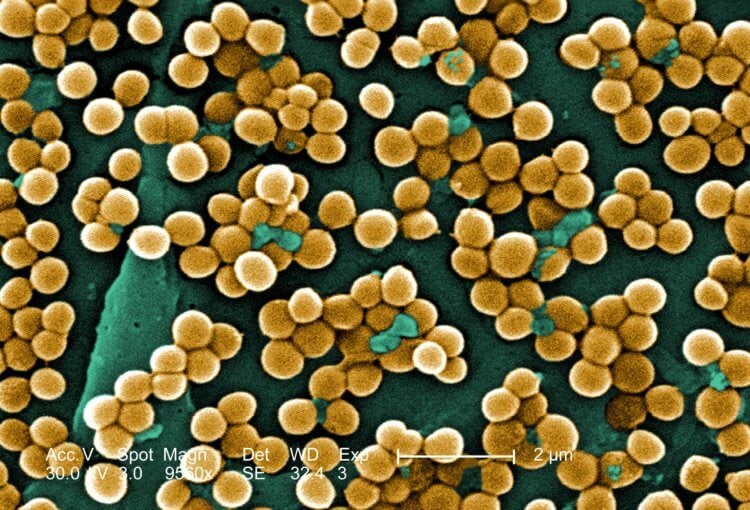 Бактерии мутируют, чтобы выжить. Так золотистый стафилококк выглядит под микроскопом. Фото.