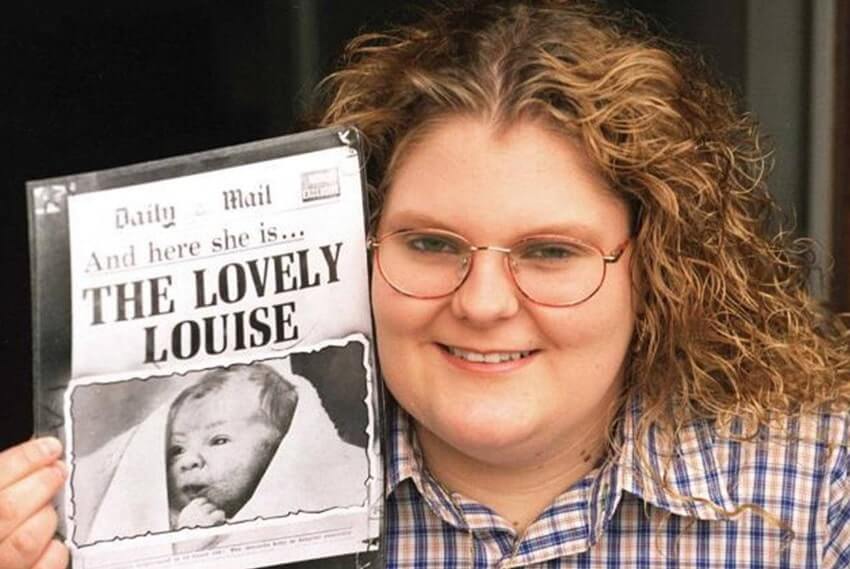 Луиза Браун — первый в мире «ребенок из пробирки». Фото.