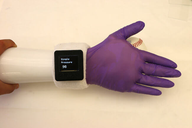 Новая высокотехнологичная перчатка сделает протезы более чувствительными. Фото.