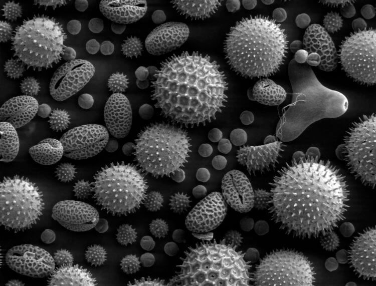 Амброзийный поллиноз — главная угроза здоровью аллергиков. Так выглядит пыльца растений под микроскопом. Фото.