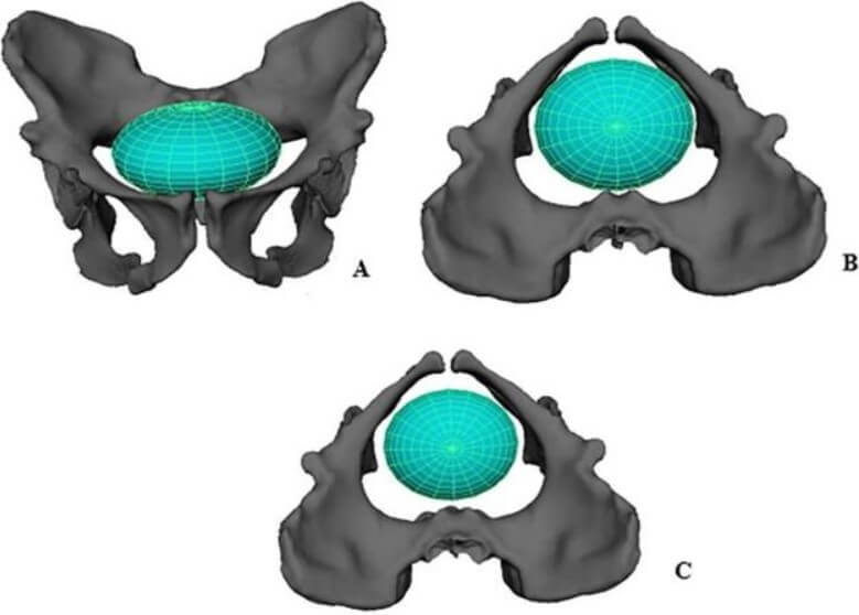 Через родовой канал Australopithecus sediba голова ребенка проходила легче, чем у современных женщин. Фото.