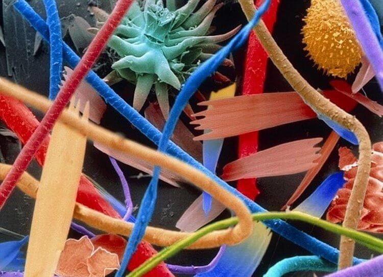 Насколько опасна домашняя пыль? Так выглядит домашняя пыль под микроскопом. Фото.