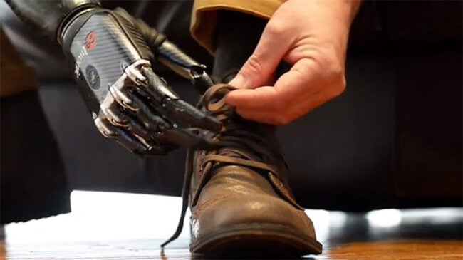 Как искусственный интеллект может улучшить протезы конечностей. Фото.