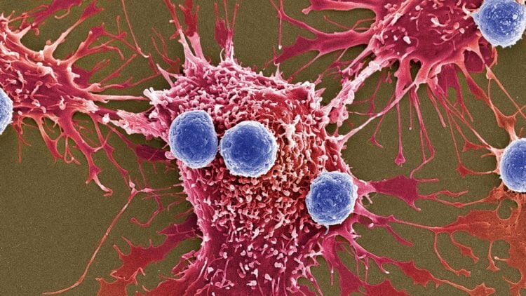 Для улучшения выживаемости раковые клетки могут пожирать себе подобных. Раковые клетки очень хорошо приспосабливаются к любым методам лечения. Фото.