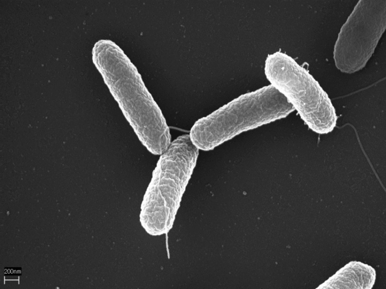 Причина сальмонеллеза. Бактерии вида Salmonella Typhimurium. Фото.