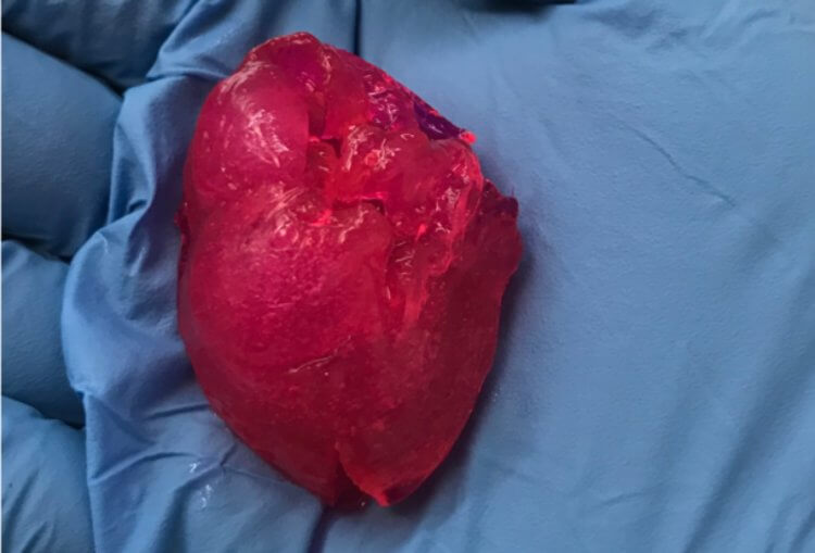 Кто напечатал человеческое сердце? Вот так выглядит напечатанное человеческое сердце в миниатюре. Фото.