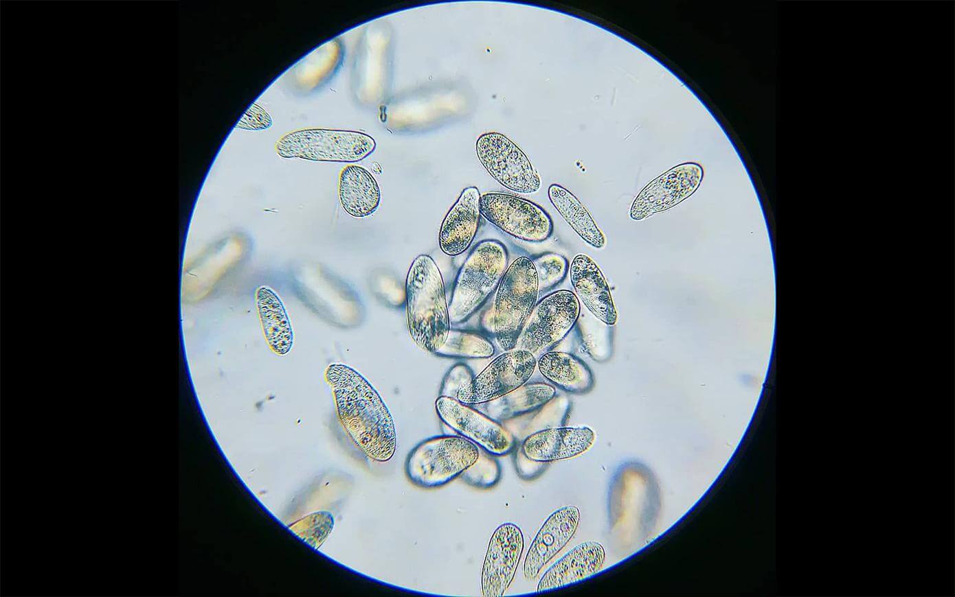 Обнаружен новый способ появления бактерий, устойчивых к антибиотикам. Бактерии нашли способ выжить без важной структуры. Фото.