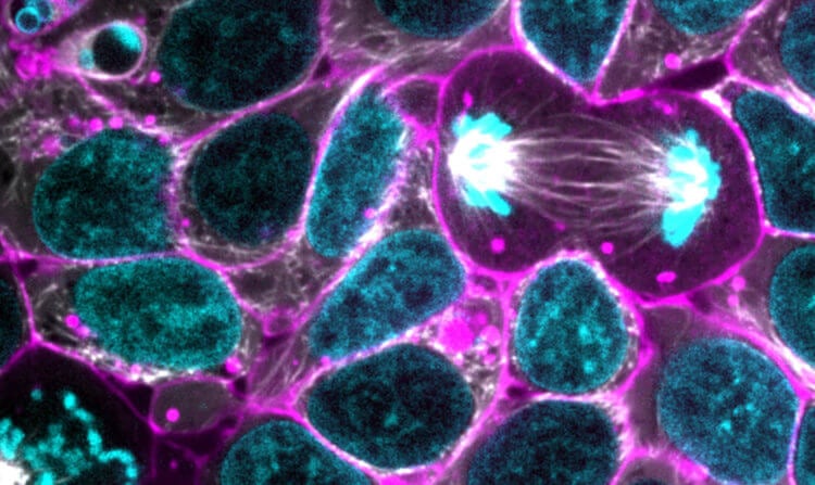 Впервые удалось остановить запрограммированную смерть клеток. Теперь можно остановить гибель тканей на клеточном уровне. Фото.