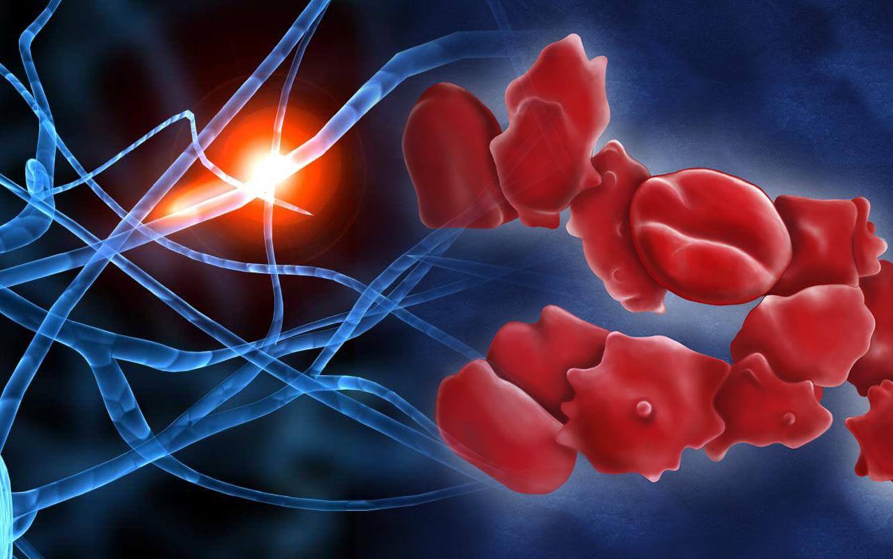 Разработан препарат для «очистки» нейронов головного мозга от токсинов. Накопление белка в головном мозге — одна из основных причин развития болезни Альцгеймера. Фото.