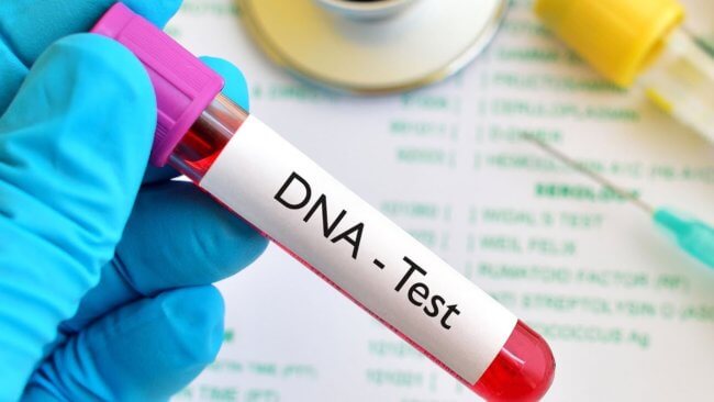 Новые генетические тесты предскажут развитие болезней. Фото.