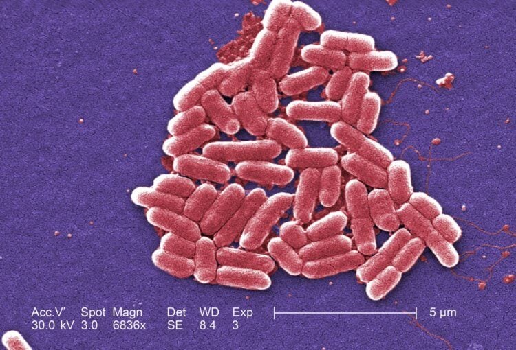 Люди, которые не моют руки после туалета, распространяют устойчивые к антибиотикам бактерии. Бактерии E.coli под микроскопом. Фото.