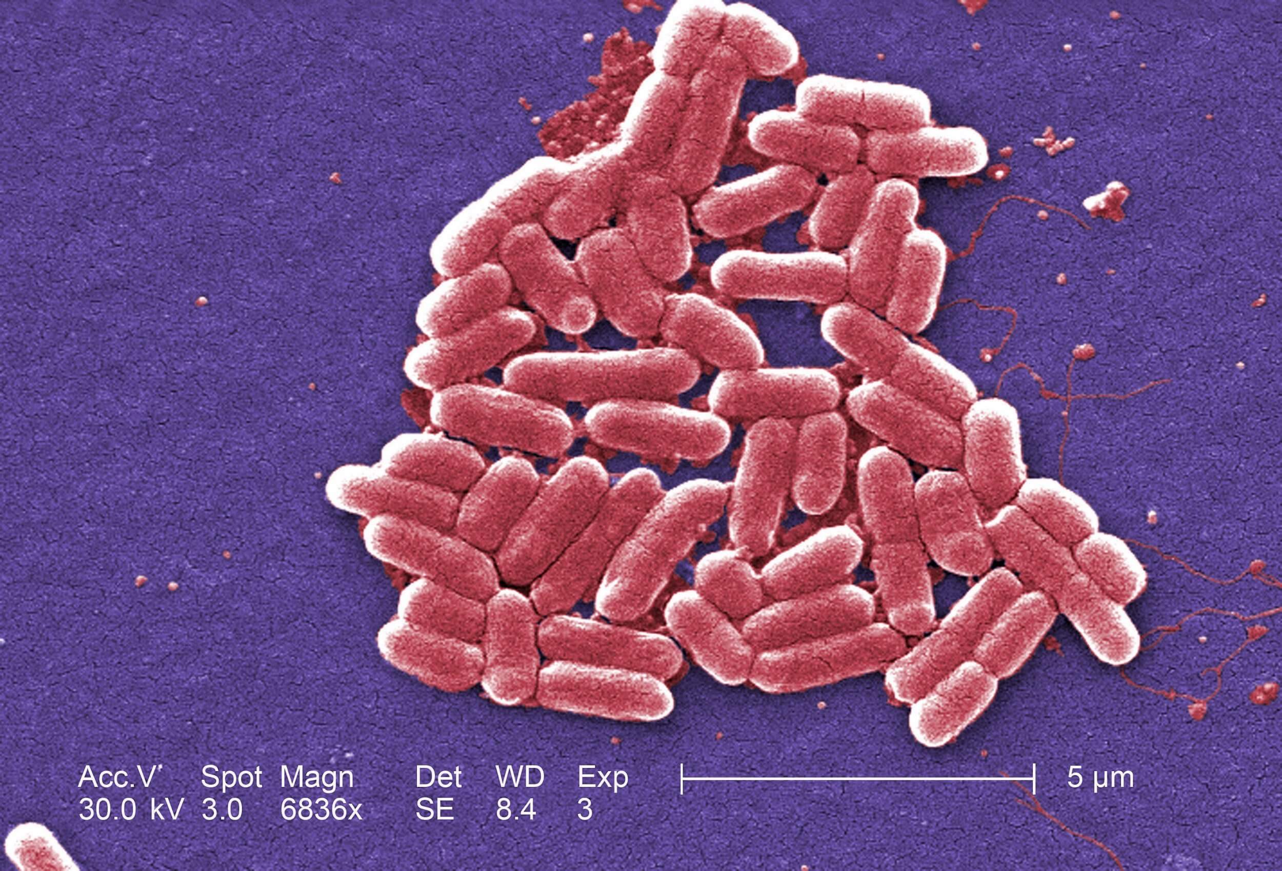 Какой микроскоп годится для изучения бактерий?