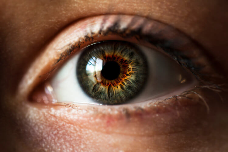Токсоплазмоз влияет на человеческое зрение. Основным офтальмологическим проявлением заболевания являются очаги на глазном дне и клеточная реакция в стекловидном теле. Фото.