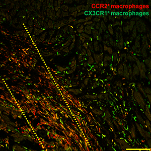 Как действительно работают стволовые клетки? Снимок клеток сердца под электронным микроскопом: иммунные клетки (обозначены красным и зеленым цветом) стекаются в поврежденную область поврежденного сердца мыши через три дня после того, как исследователи ввели стволовые клетки сердца (область введения обозначена желтым). Фото.