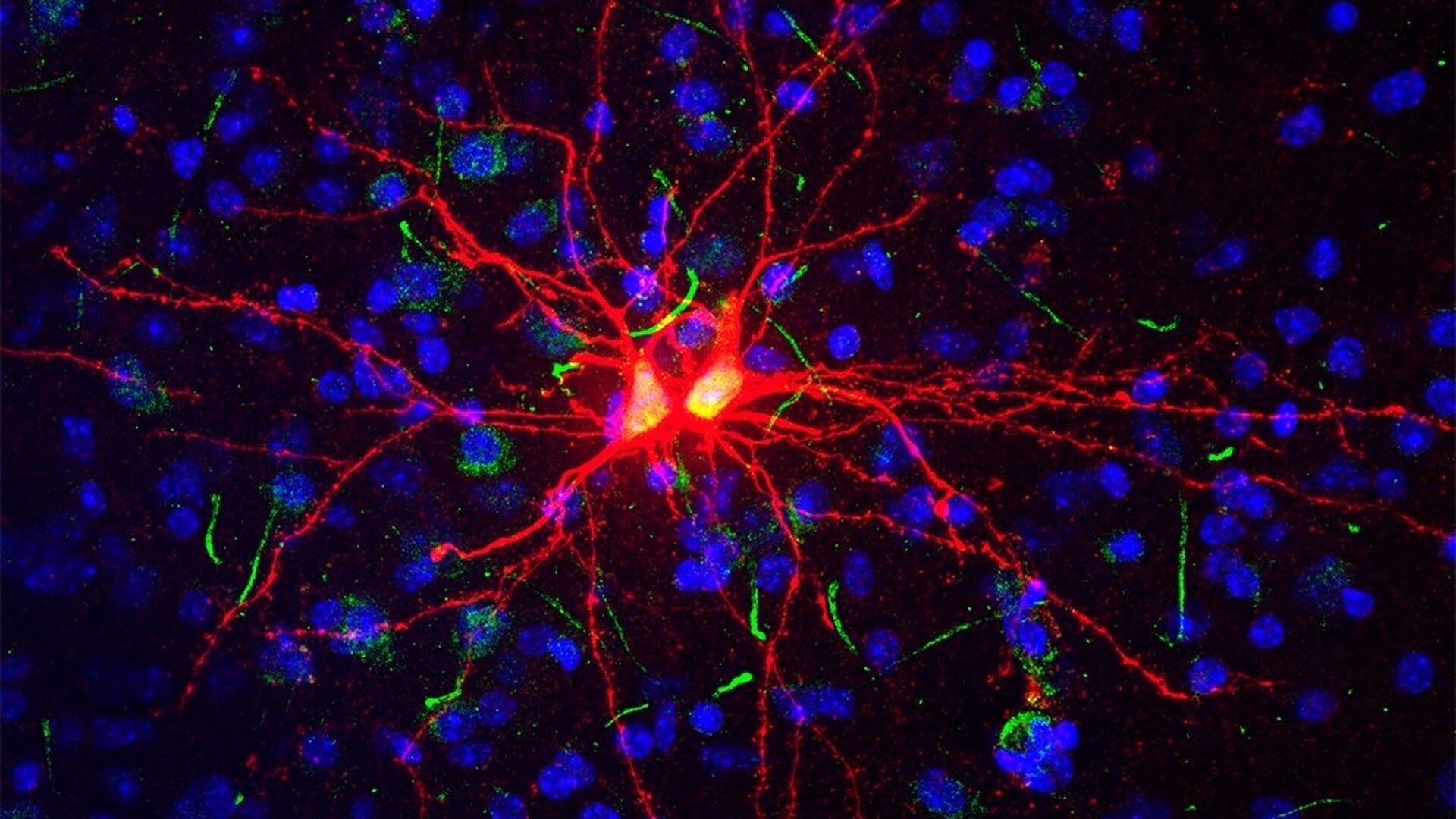 Новые клетки мозга. Нейронные микросети. Клетки мозга. Нейроны мозга. Нейронные связи головного мозга под микроскопом.