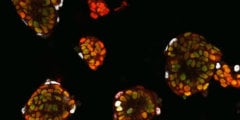 Ученые выяснили, как стволовые клетки «понимают», в какую клетку им нужно превратиться. Фото.