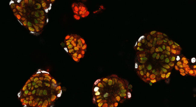 Ученые выяснили, как стволовые клетки «понимают», в какую клетку им нужно превратиться. Фото.