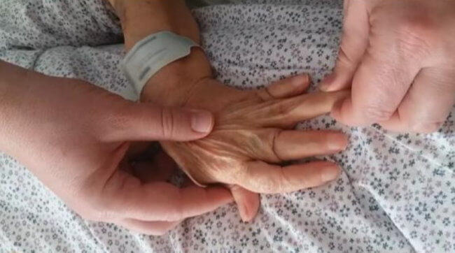 #видео | Что может произойти с руками человека при осложнении артрита? Фото.