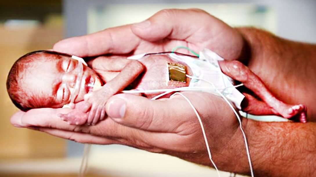 На 26 неделе беременности вес ребенка в среднем составляет около 760 грамм при росте всего 35 сантиметров. Фото.