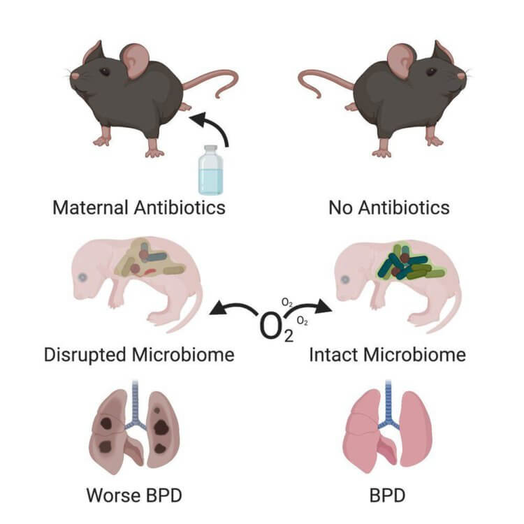 Как антибиотики влияют на выживаемость новорожденных? Воздействие антибиотиков вызывало более тяжелую форму бронхолегочной дисплазии у мышей. Фото.