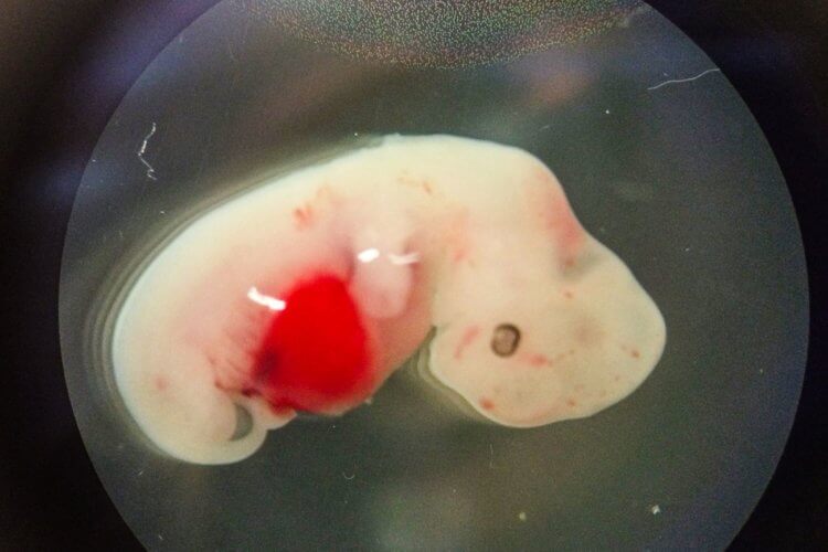 Как скрестить обезьяну и человека. Это эмбрион химеры человека и свиньи. Фото.