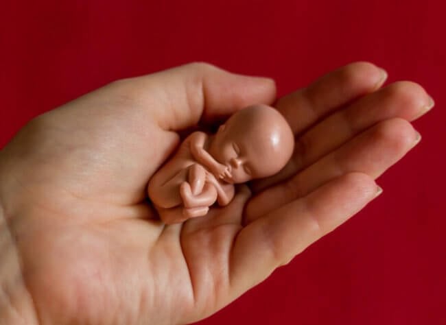 Как аборты влияют на эмоциональное состояние женщин? Фото.