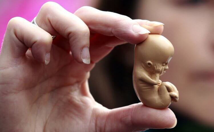 Как женщины относятся к абортам? Аборт делается при сроке до 20 недель беременности или при весе плода до 400 грамм. Фото.