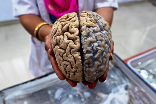 Может ли человеческий мозг не разлагаться тысячи лет? Фото.