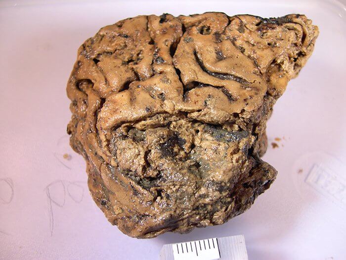 Сколько времени разлагается человеческий мозг? Мозг человека, найденный в английской деревне. Фото.