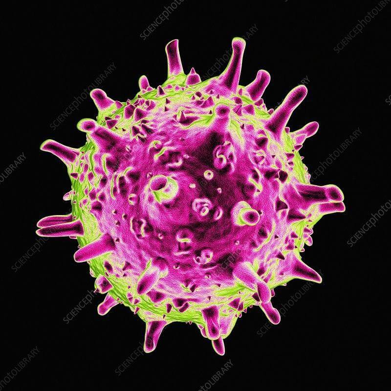 Тяжелый острый респираторный синдром также известен как пурпурная смерть. Фото.