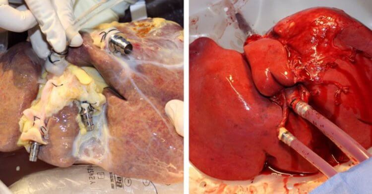 Как аппарат поддерживает функционирование печени? Слева поврежденная печень, справа — восстановленный с помощью перфузии орган. Фото.