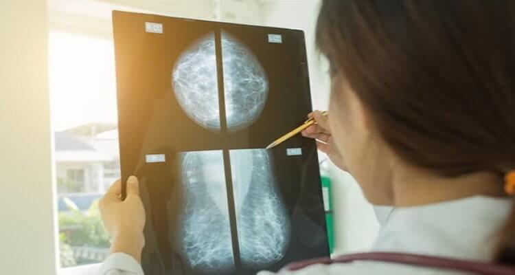 Как выявить рак молочных желез. Изучение рентгеновских снимков, полученных при помощи маммографа. Фото.