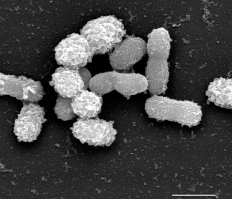 От чего зависит характер человека? Кишечные бактерии Akkermansia. Фото.
