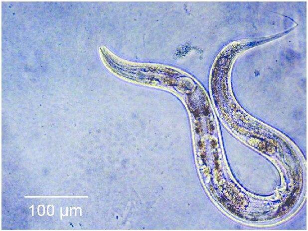 Можно ли избавиться от старости? С помощью круглых червей вида Caenorhabditis elegans ученые изучают процессы старения, поскольку те имеют схожие с человеком гены. Фото.