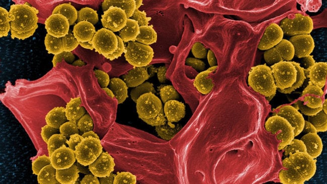Микробы, замедленные одним антибиотиком, развивают устойчивость к другим. Фото.