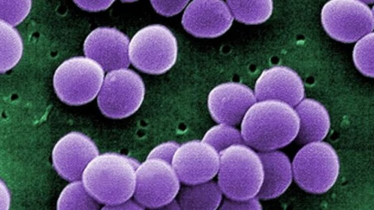 Что это значит для пациентов? Так выглядит под микроскопом устойчивый к антибиотикам золотистый стафилококк. Фото.