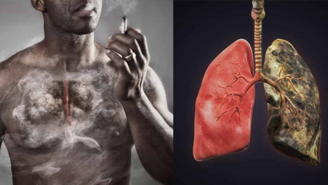 Восстанавливаются ли клетки легких после того, как человек бросил курить? Фото.