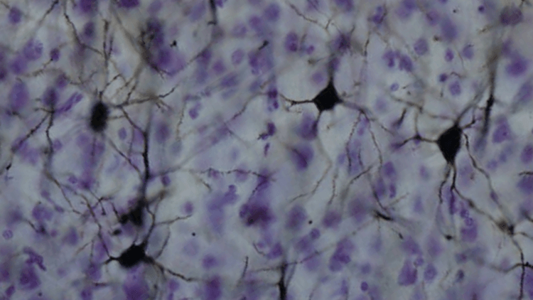 Почему дендриты в мозге человека — особенные? Мозг человека по-прежнему полон тайн. Фото.