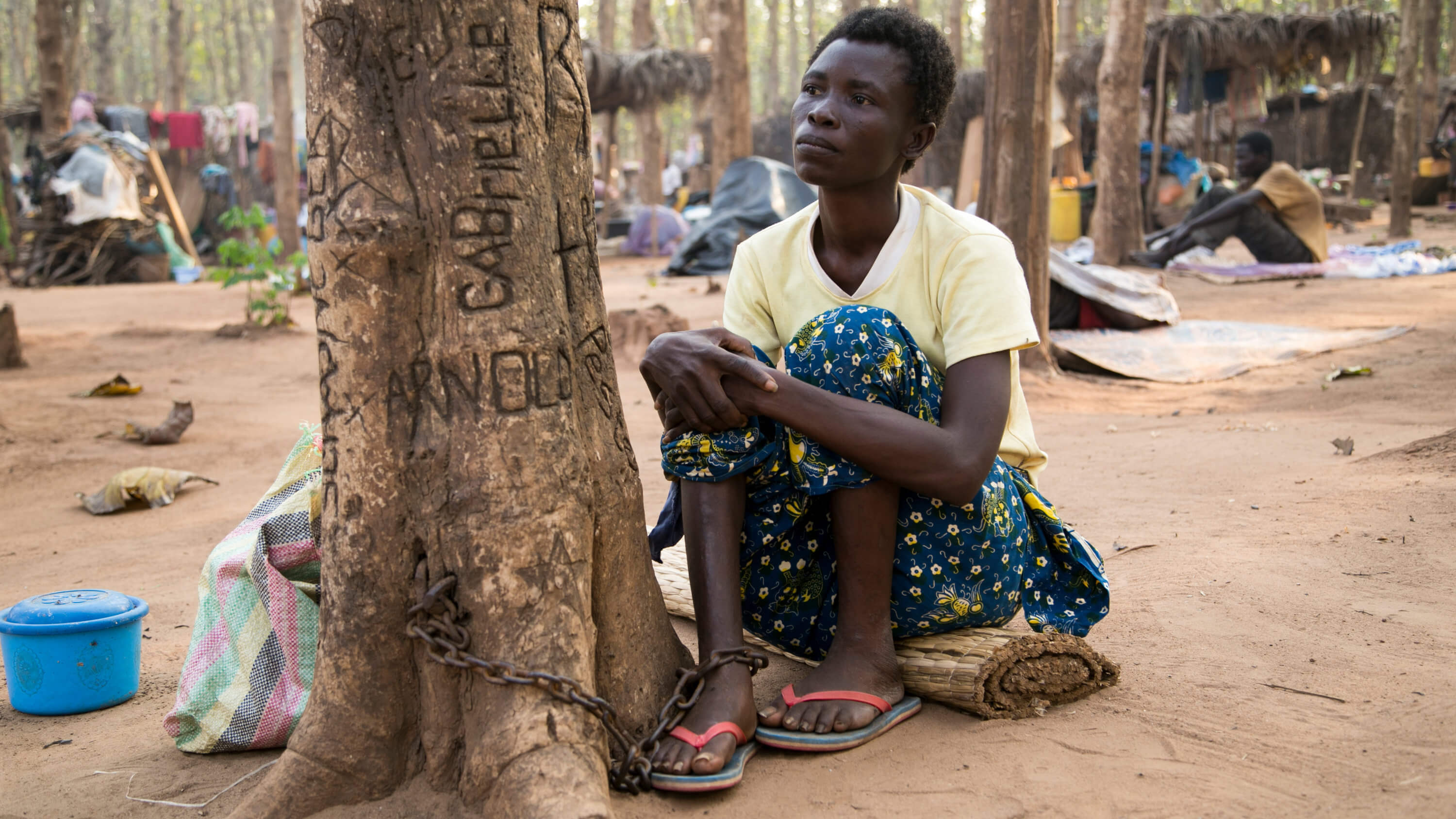 Симптомы шизофрении могут проявляться по-разному. Фото.