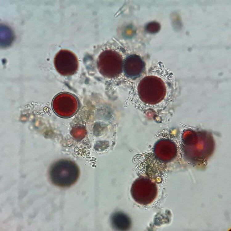 Из-за чего снег в Антарктиде окрасился в красный цвет? Так выглядят снежные хламидомонады (Chlamydomonas nivalis) под микроскопом. Фото.