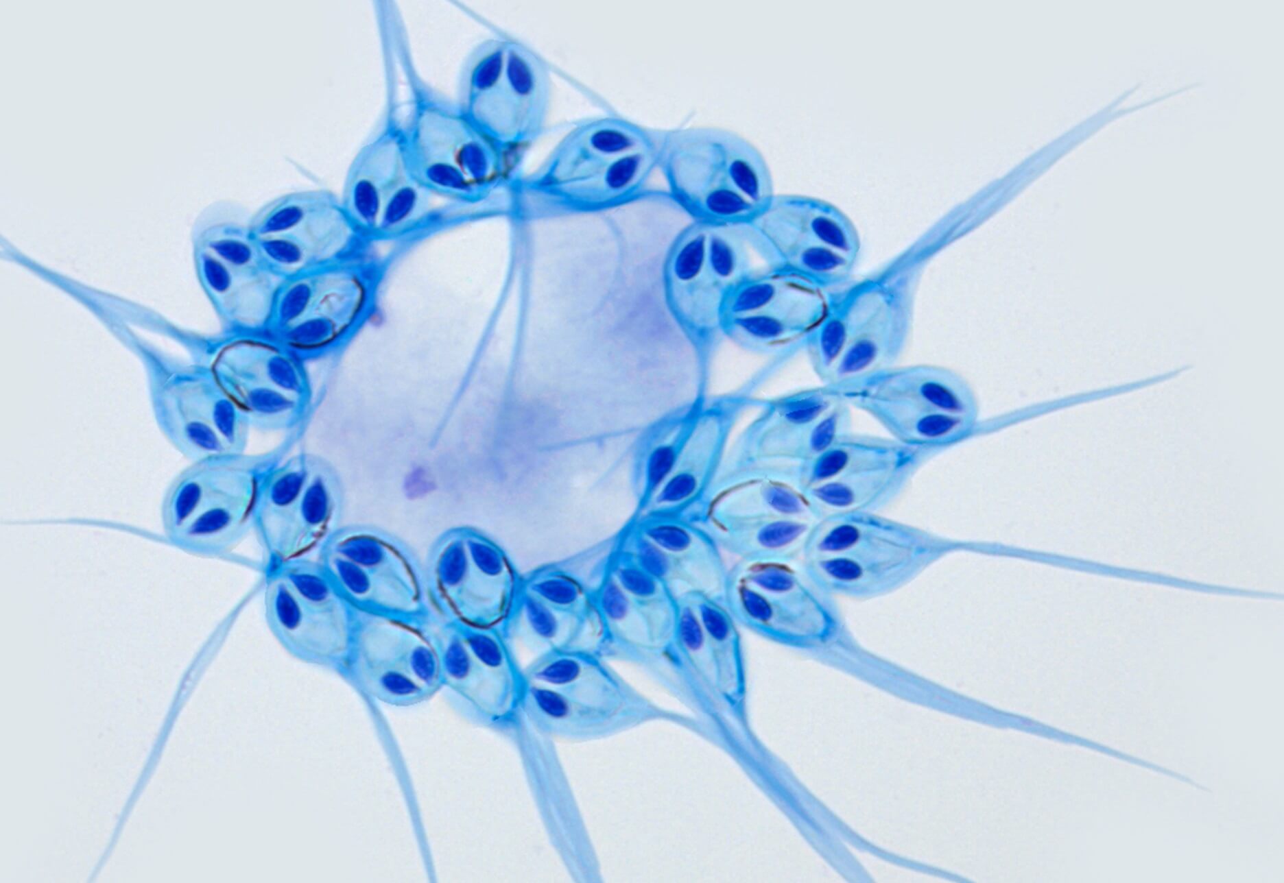 Так выглядит Henneguya salminicola. Фото.